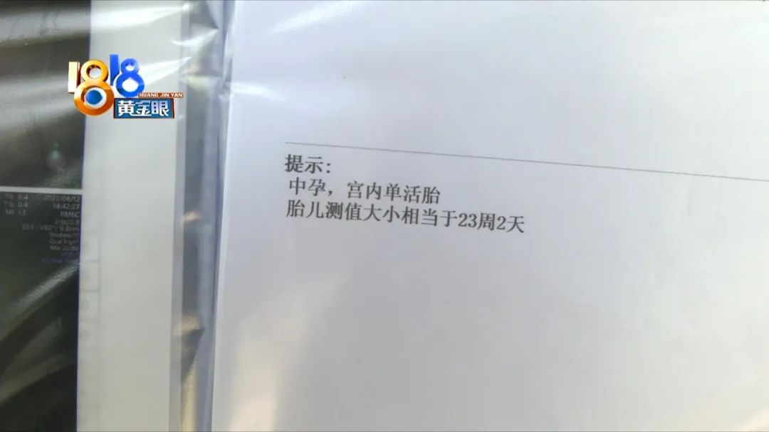 DƬ